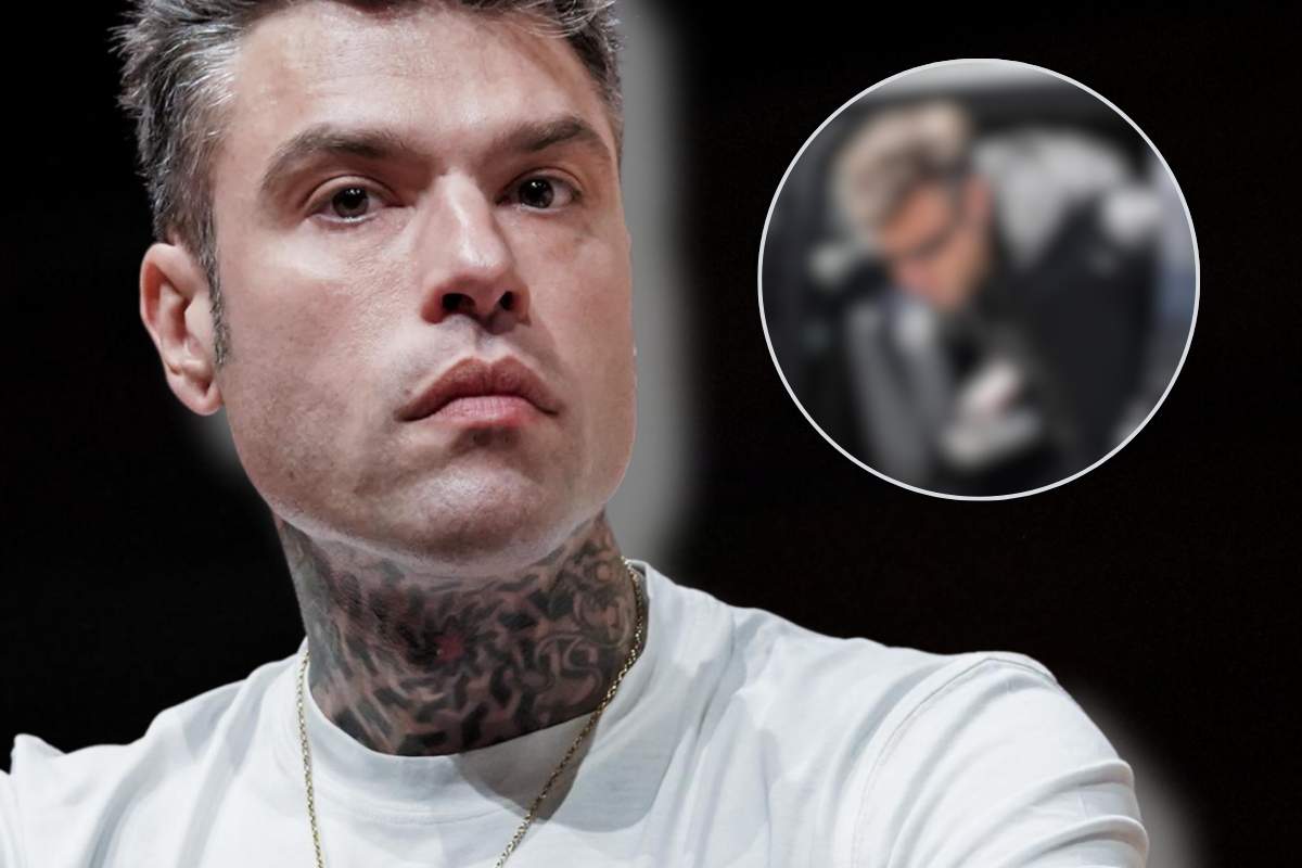 Fedez infortunio